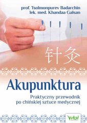 Akupunktura